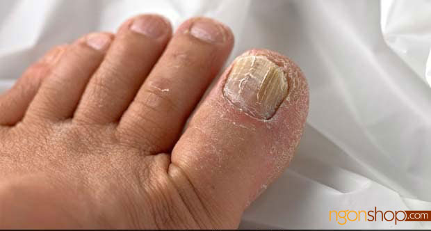 15 dấu hiệu bạn đang thiếu hụt canxi máu 29