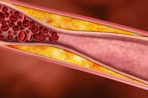 Những tác dụng của đậu đỏ và cách nấu chè đậu đỏ bổ dưỡng 15 tác dụng của đậu đỏ
